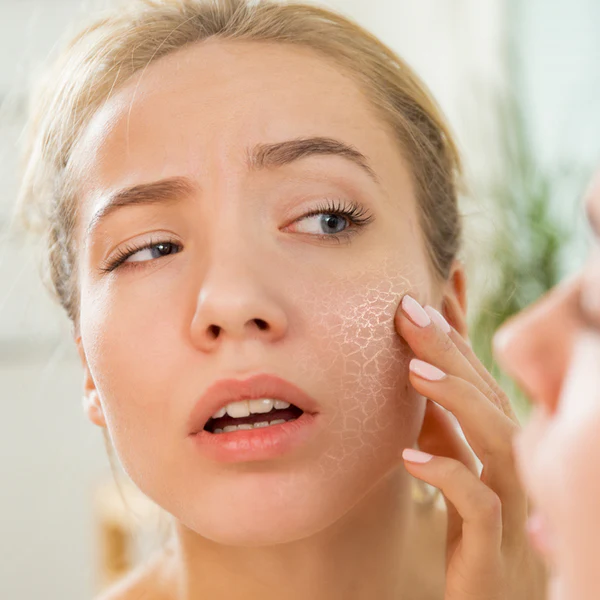 Dry skin? This 7-step routine could rescue your barrier fast