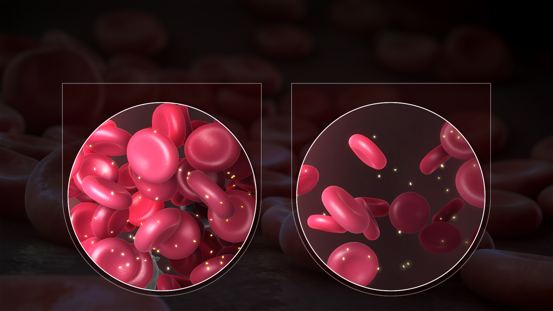 Anaemia in India: More Than Just an Iron Deficiency
