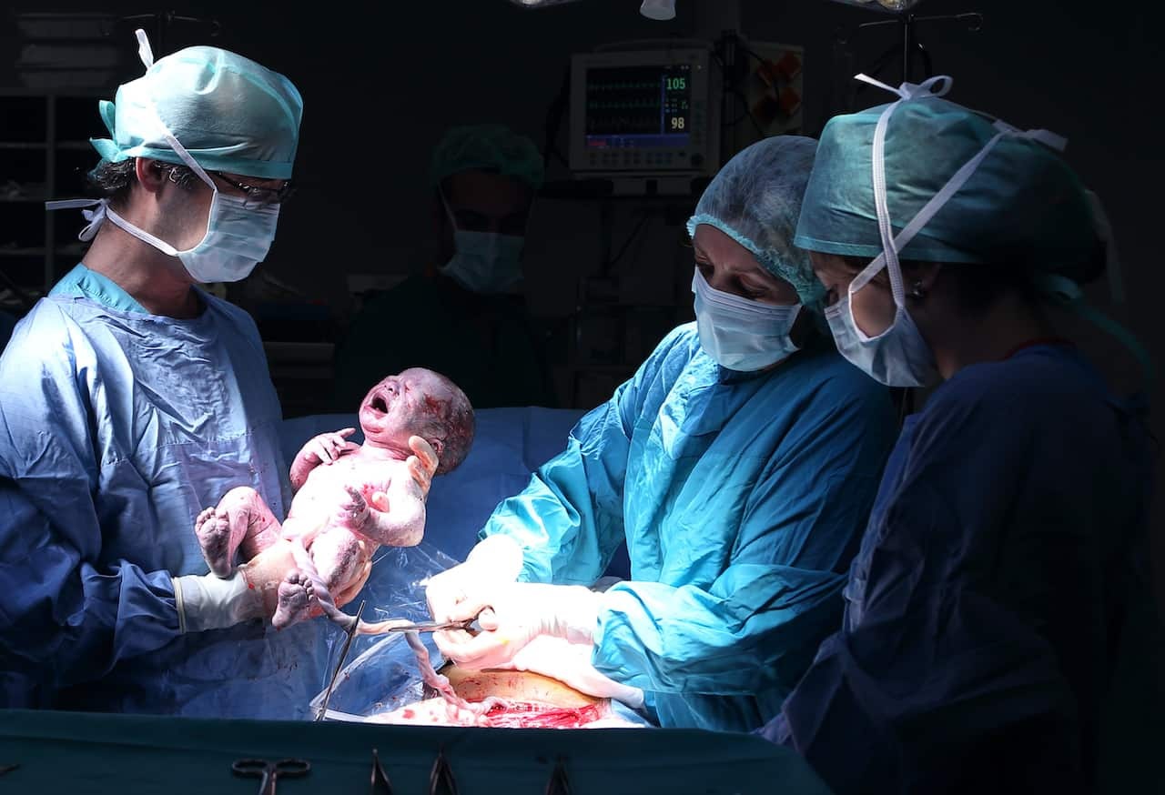 Elective C-Section- A safe choice or a risky gamble?
