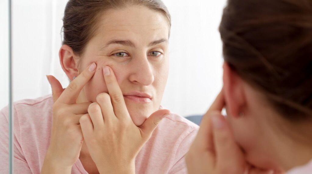 Say Goodbye to Menopause Breakouts with These Easy Tips!