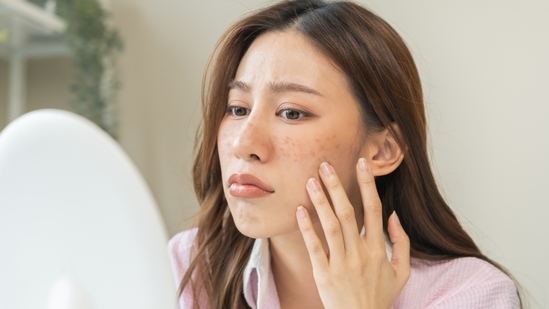 How to not let makeup ruin your skin