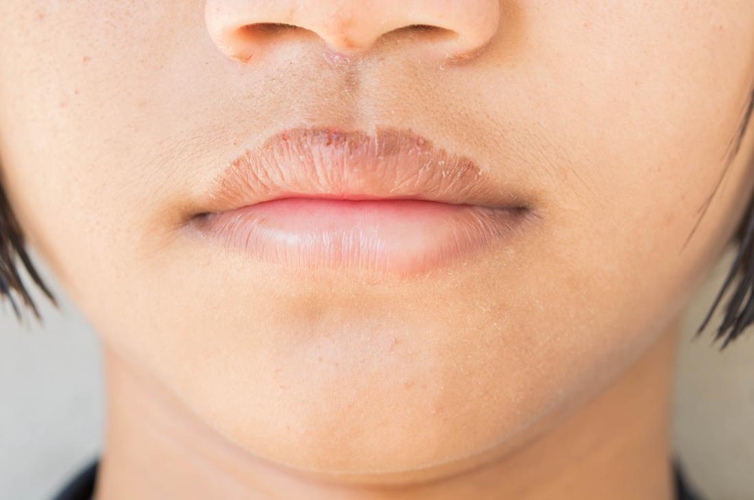 You're Using Lip Balm Wrong! Try This Instead