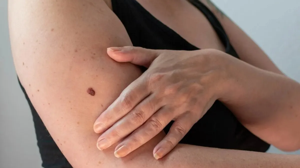 Skincare alert: Common beauty habits may raise skin cancer risk