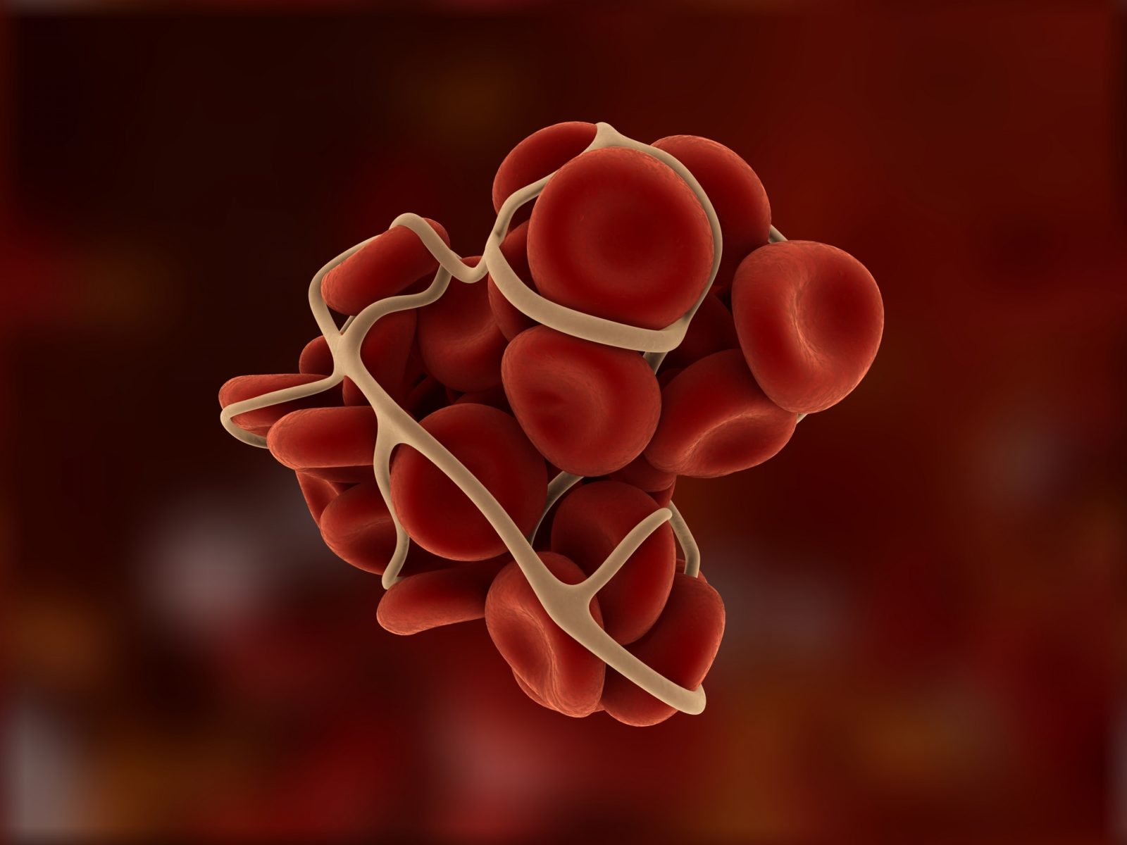 Going places with haemophilia? Pack meds, not panic!