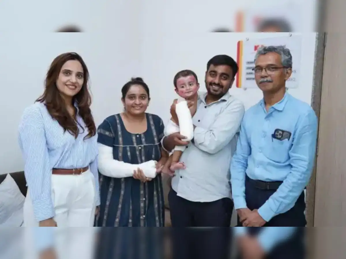 Baby burned in Air India crash, survives with mother’s skin