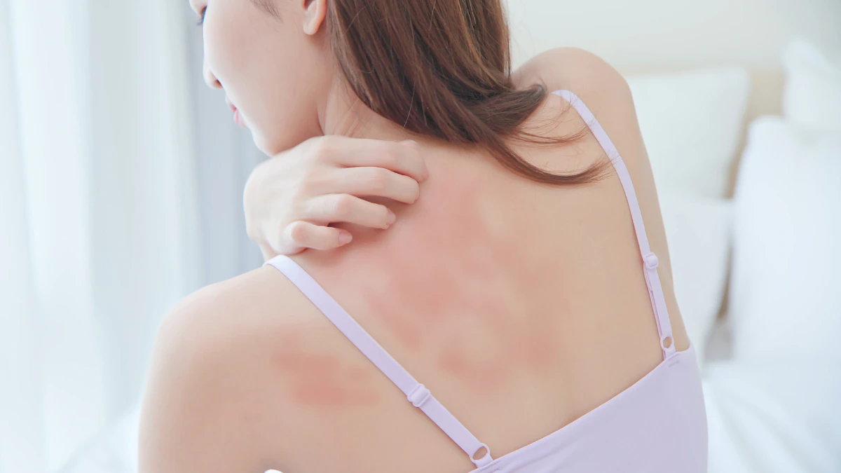 STOP! Don't Step Out This Summer Without Reading This First!