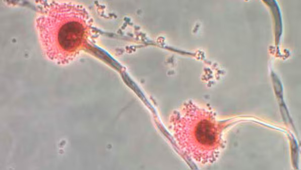 Could climate change unleash fungi that destroy you from within?