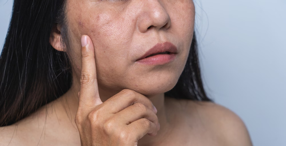 Not just aging, 5 skin changes that reveal hidden health issues
