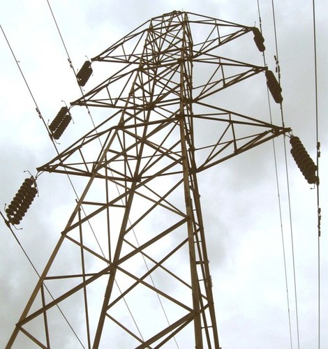 7 year old child loses hands to 11,000V wire in U.P.!