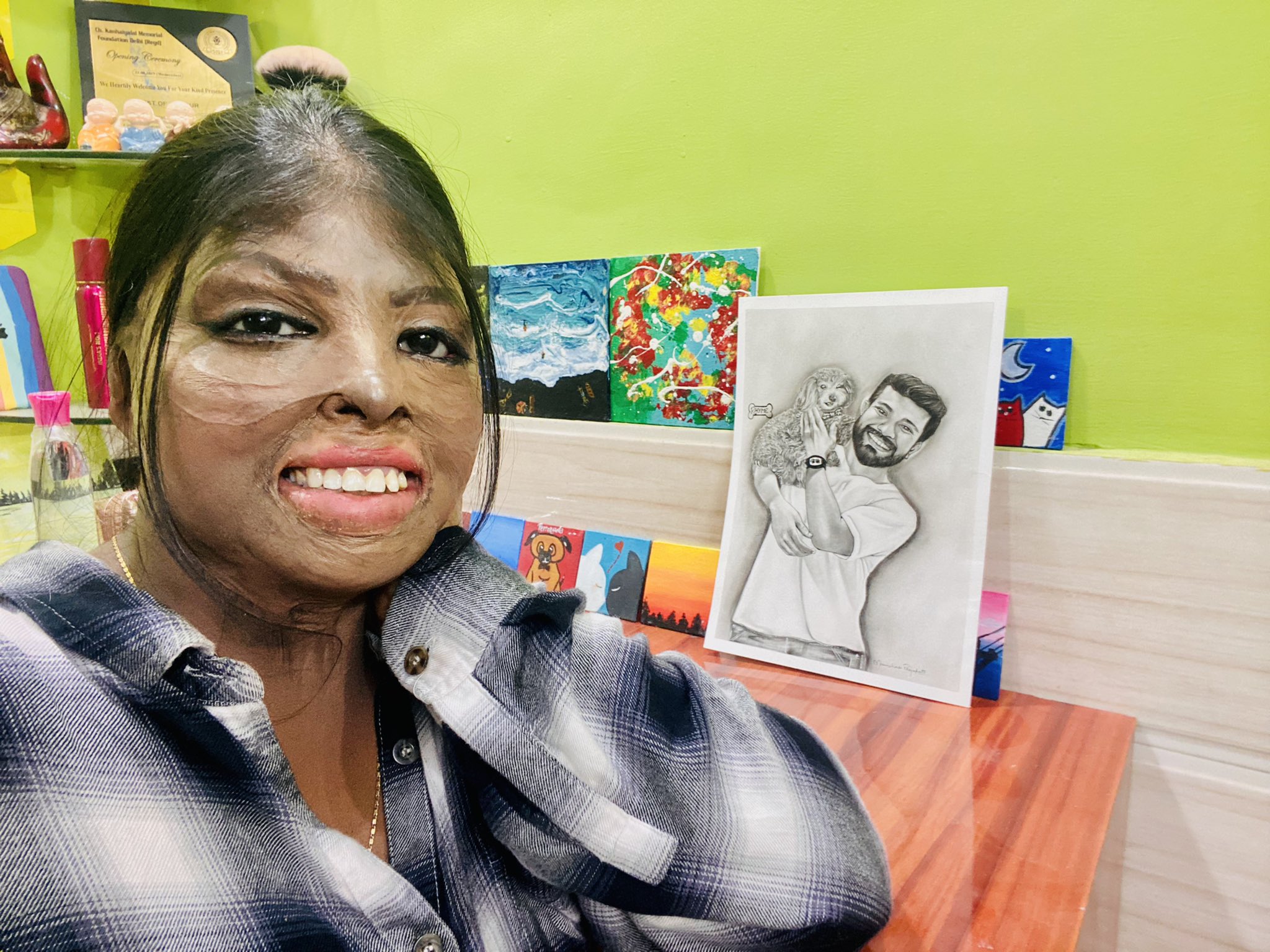 Burn survivor Mannu redraws beauty on her own terms!
